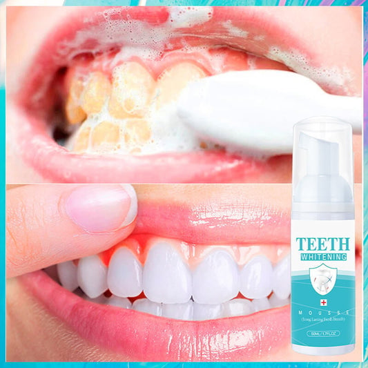 Teeth Whitening Mousse 🔥