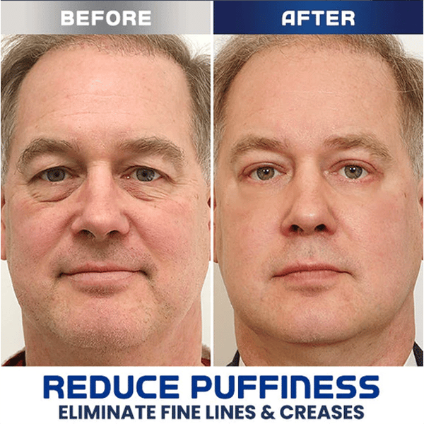 Snake Venom Peptide Anti-Wrinkle Eye Cream