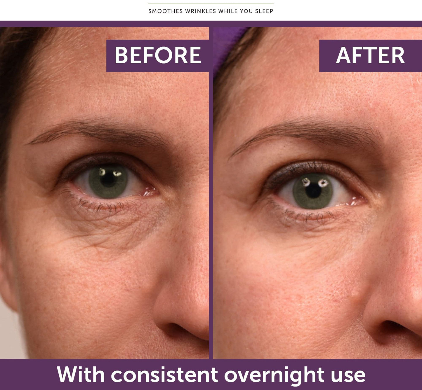 Snake Venom Peptide Anti-Wrinkle Eye Cream