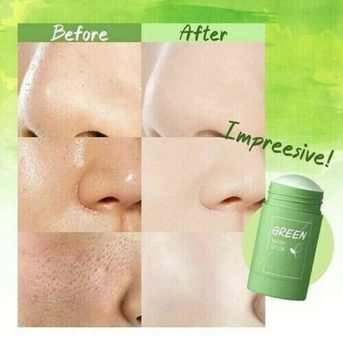 🔥BIG SALE - 70% OFF🔥Non-Porous Deep Cleansing Mask Pen