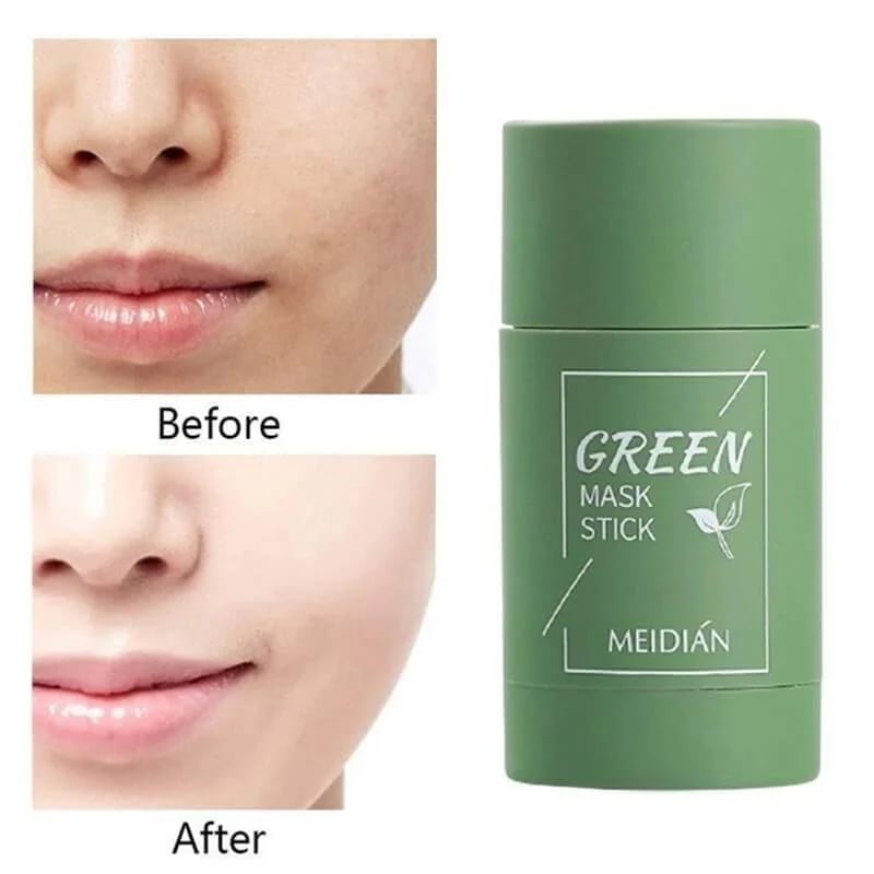 🔥BIG SALE - 70% OFF🔥Non-Porous Deep Cleansing Mask Pen